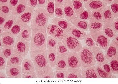 Metaphase Microscope