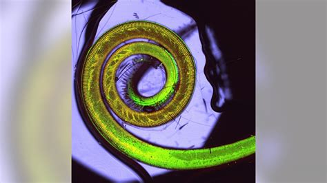 Dewdrops & butterfly tongues: Tiny worlds come to life in microscope ...