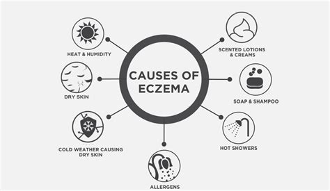 Eczema and your skin - Epizone