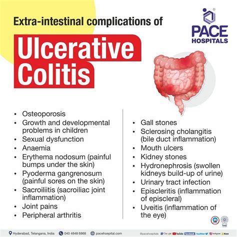 Ulcerative Colitis – Symptoms, Causes, Types and Complications