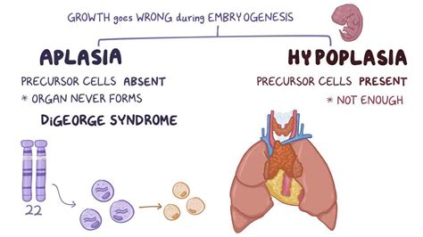 Cachexia: What It Is, Causes, Signs and Symptoms, and More | Osmosis