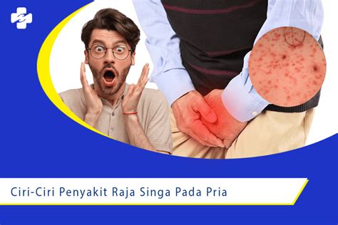 Ciri-ciri Gejala Penyakit Raja Singa pada Pria | Klinik Utama Sentosa