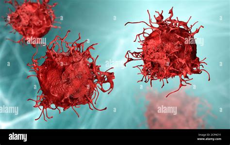 Skin cancer cell hi-res stock photography and images - Alamy