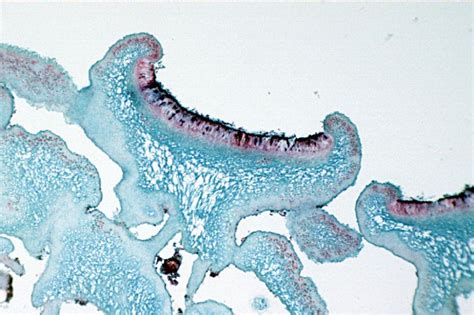 Difference Between Apothecium and Cleistothecia | Compare the Difference Between Similar Terms