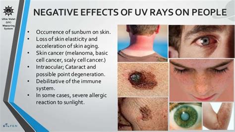 Ultraviolet Radiation Effects