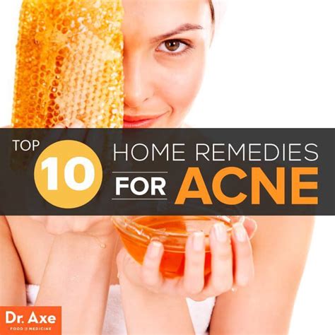 10 Home Remedies for Acne That Work - Dr. Axe | Home remedies for acne ...