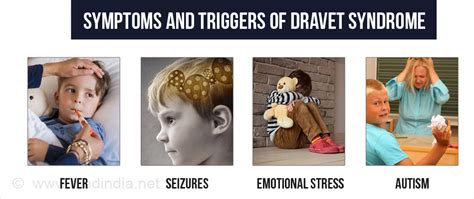 Dravet Syndrome - Causes, Symptoms, Diagnosis, Treatment, Prevention