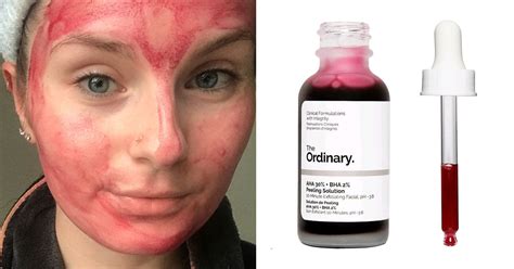 The Ordinary AHA 30% + BHA 2% Peeling Solution Review | POPSUGAR Beauty UK