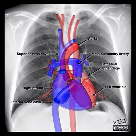 Pin by Ashley on Interesting tidbits | Radiology, Radiography, Interventional radiology