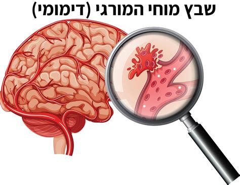 שבץ מוחי סוגים: שבץ איסכמי, שבץ המורגי | פייזר ישראל