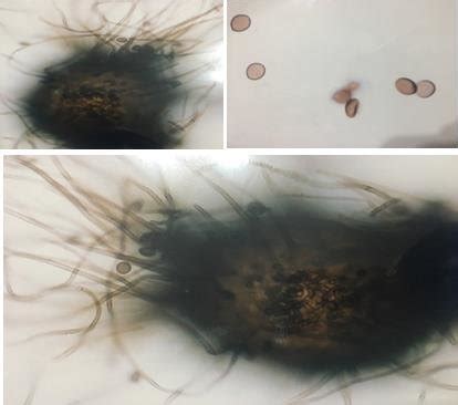 Chaetomium species with spiral setea and with oval ascospores. isolated... | Download Scientific ...