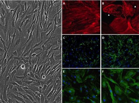 HTMC Introduced | Human Trabecular Meshwork Cells | Cell Applications