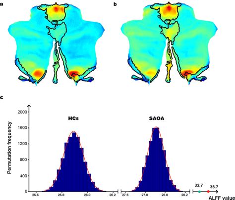 Characteristics of ALFF in regions with altered GM volume. Flatmaps ...