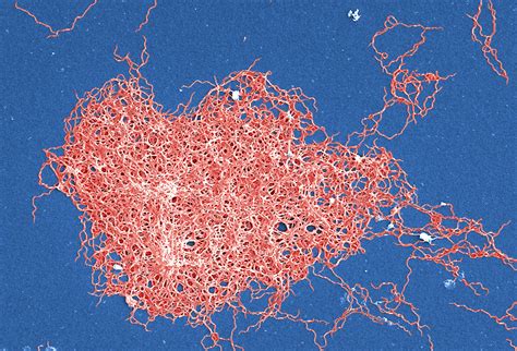 Free picture: burgdorferi, bacteria, infect, several, parts, body ...