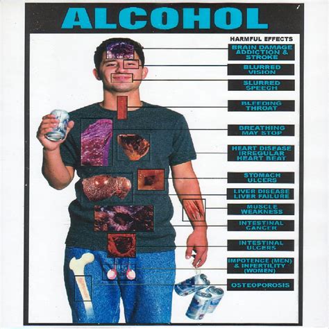 Teen Obesity: Harmful Effects of Alcohol On Teens