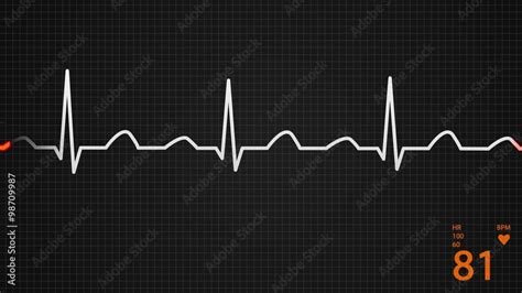 Animation of a schematic diagram of normal sinus rhythm for a human heart vídeo de Stock | Adobe ...