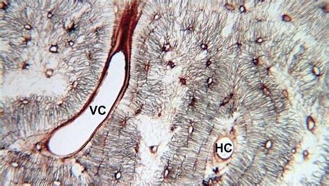 Volkmann canal | anatomy | Britannica