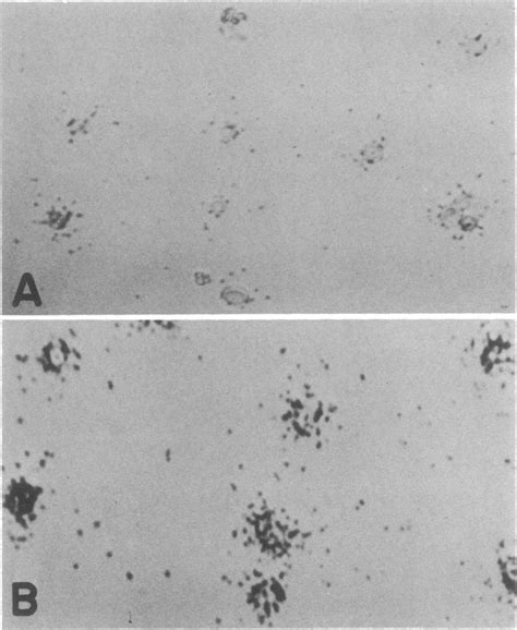 Light micrographs of akinetes labeled with 35S and exposed to emulsion ...