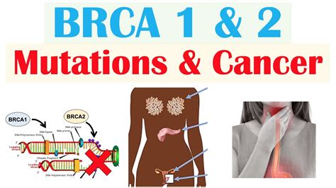 BRCA1 and BRCA2 Mutations & Cancer (Types of Cancer, and Who’s Most At ...