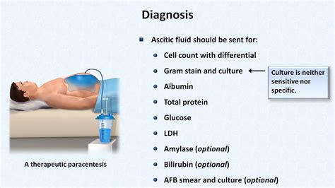 Spontaneous Bacterial Peritonitis - YouTube