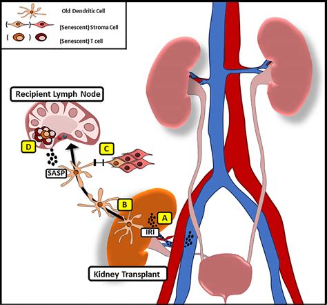 Frontiers | Donor and Recipient Age-Mismatches: The Potential of ...