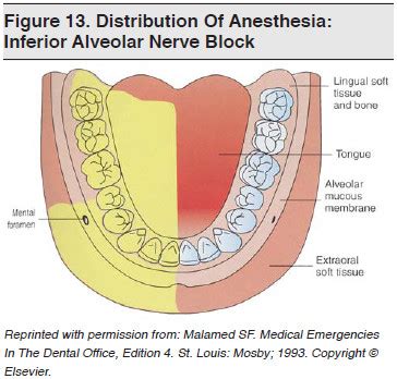 Inferior Alveolar Nerve Block Landmarks