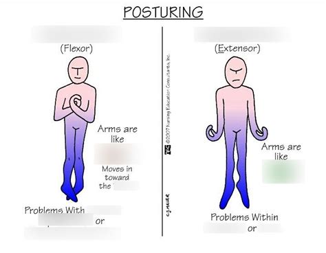 Decorticate vs Decerebrate Posturing Diagram | Quizlet