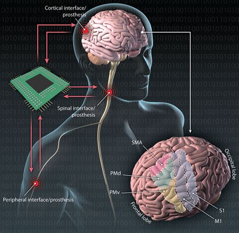 Translating the Brain-Machine Interface | Science Translational Medicine