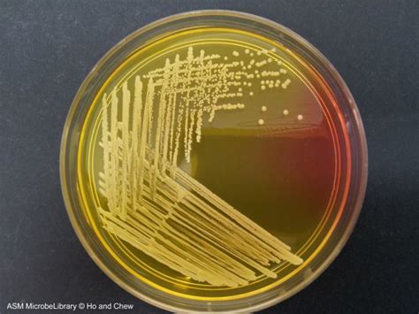 Staphylococcus Epidermidis Streak Plate