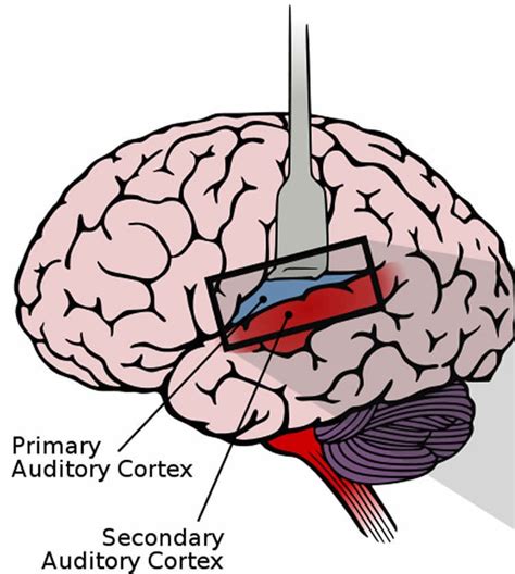 The Auditory Cortex of Hearing and Deaf People are Almost Identical ...