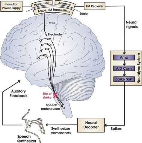 Neural Prosthetics for Speech Restoration | Guenther Lab