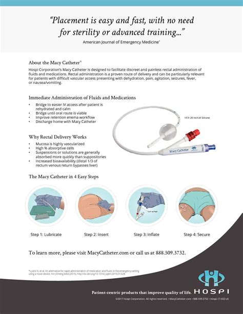 Product Info - The Macy Catheter