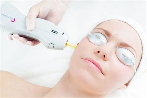 Laser Skin Tightening – Absolute Face & Body Medspa