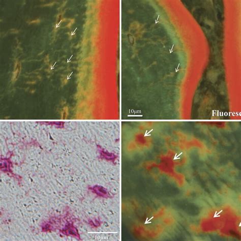 (A) Osteocyte canaliculi after total parathyroidectomy (PTX) in group... | Download Scientific ...