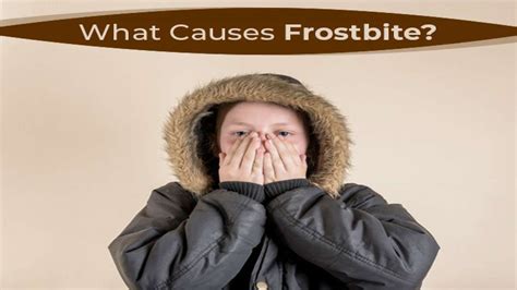 Frostbite: Causes, Symptoms, Stages, Risk Factors, Diagnosis ...