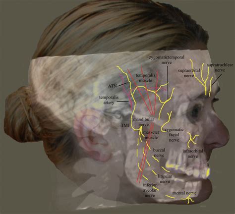 Supraorbital Nerve Entrapment: Face | SpringerLink