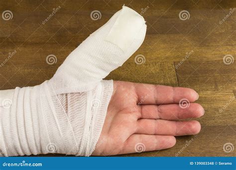 Injured thumb with bandage stock photo. Image of thumb - 139003348