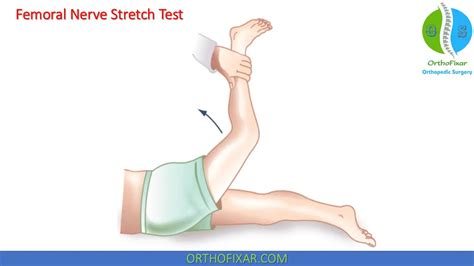 Femoral Nerve Stretch Test | OrthoFixar 2024