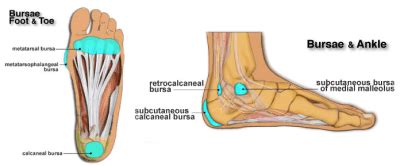 Medial Ankle Bursitis