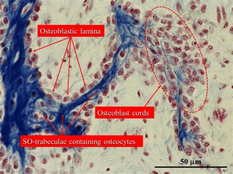 Intramembranous Ossification Slide