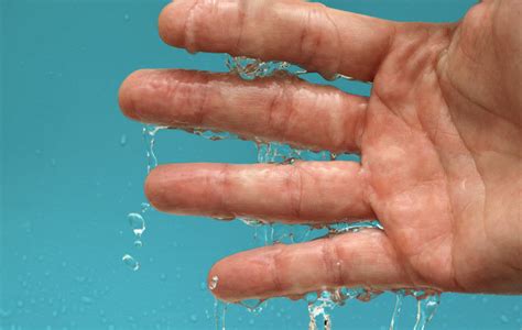 Natural Remedies for Sweaty Palms — HealthDigezt.com