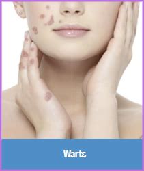 Birmingham Med Spa | Laser Skin Care, Acne, Scar & Wart Treatments