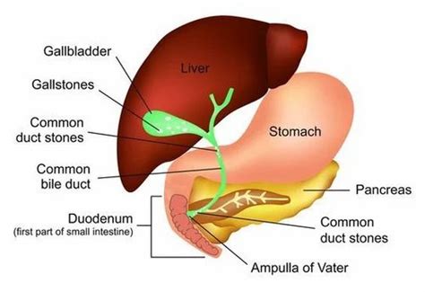 CBD Stones Treatment in New Delhi | ID: 16526903912