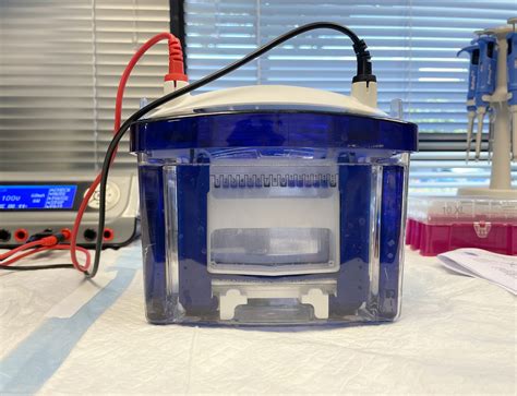 Electrophoresis 101: the Difference between Running and Transfer Buffer (2024)