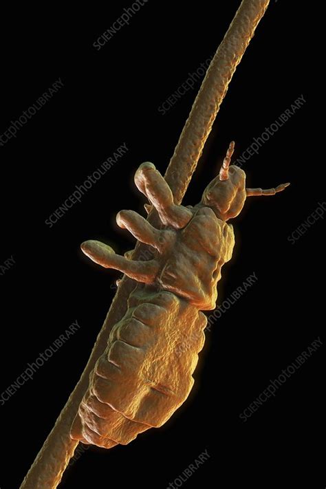 Head Louse, artwork - Stock Image - C020/3985 - Science Photo Library