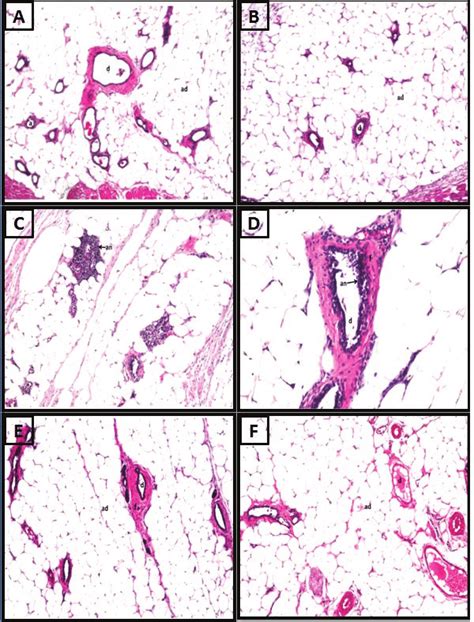 Photomicrograph of mammary glands in control (A) and UPME-treated rats... | Download Scientific ...