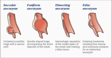 Cardiovascular System | Basicmedical Key