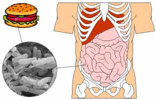 E. coli food poisoning