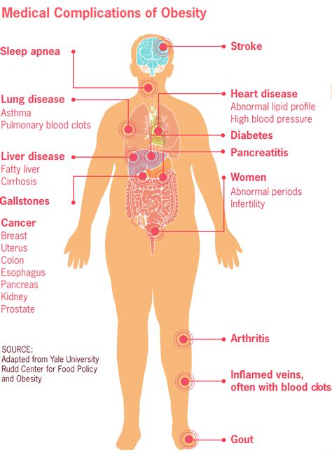 Baby’s Toxic Bottle: Study Says BPA Leaching Causes Adverse Effects