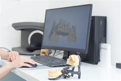 Dental 3D Printing - Dimples Family Dentistry